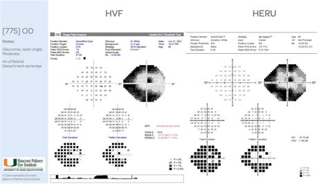 Vision field diagnostics miniWP Feb09 .